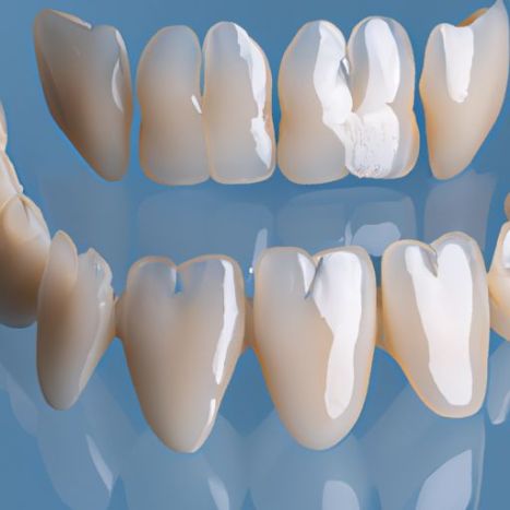 in tanden 2 paar fineren Klik-tanden fineren voor lesgeven in tanden Perfecte beugels en alternatief voor bleken Geen pijn Geen shot Tandenverzorging Fineer Snap